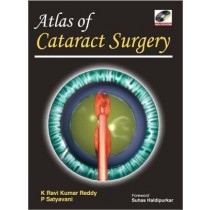 Atlas of Cataract Surgery