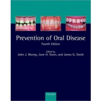 Prevention of Oral Disease, 4e **