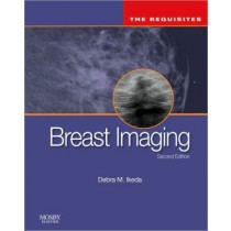 Breast Imaging, The Requisites, 2nd Edition