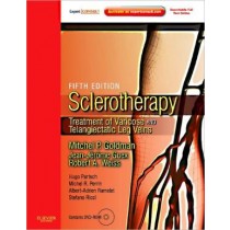 Sclerotherapy Treatment of Varicose and Telangiectatic Leg Veins, 5e