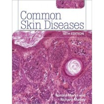 Common Skin Diseases, 18e