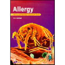 Allergy: An Illustrated Colour Text **