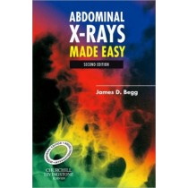 Abdominal X-Rays Made Easy, International Edition, 2nd Edition