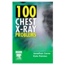 100 Chest X-Ray Problems IE