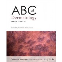 ABC of Dermatology, 6e