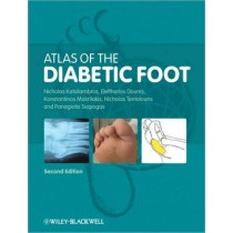 Atlas of the Diabetic Foot, 2e