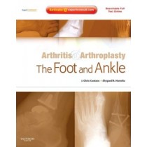 Arthritis and Arthroplasty: The Foot and Ankle, Expert Consult - Online, Print and DVD