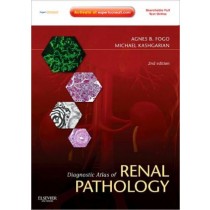 Diagnostic Atlas of Renal Pathology, 2e