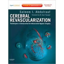 Cerebral Revascularization