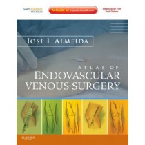 Atlas of Endovascular Venous Surgery