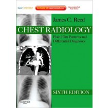 Chest Radiology, 6th Edition