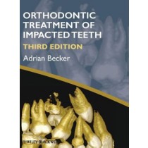 Orthodontic Treatment of Impacted Teeth, 3e
