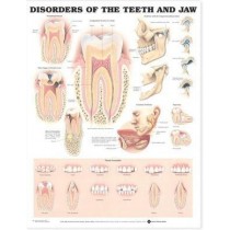 Disorders of the Teeth and Jaw Chart