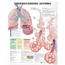 Understanding Asthma Chart 2E