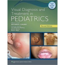 Visual Diagnosis and Treatment in Pediatrics 2e **