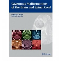 Cavernous Malformations of the Brain and Spinal Cord