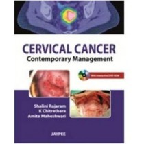Cervical Cancer : Contemporary Management
