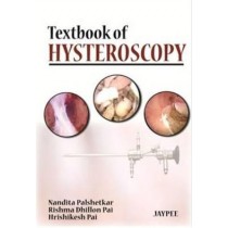 Textbook of Hysteroscopy