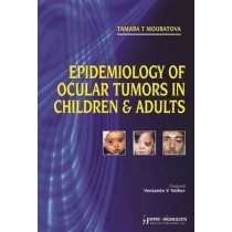 Epidemiology of Ocular Tumors in Children and Adults