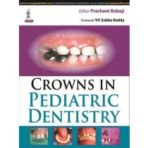 Crowns in Pediatric Dentistry