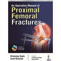 An Operative Manual of Proximal Fractures 