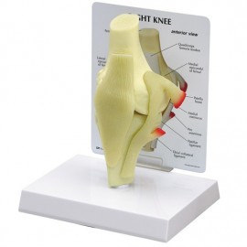 Basic Knee Model