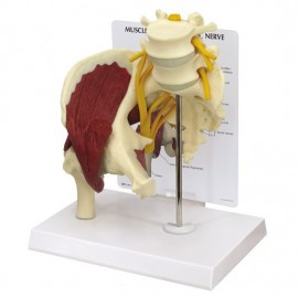 Hip Joint Model with Muscles and Sciatic Nerve