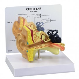 Ear Model (oversize) - Child's Ear with Otitis Media