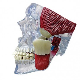 TMJ Model - Clear skull with Muscles and Ppathologies