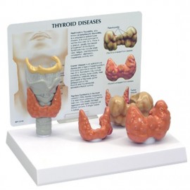 Thyroid Disorders Model