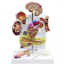 Type-2 Diabetes Set Model: Brain, Eye, Heart, Kidney, Artery, Pancreas, Foot, Nerve