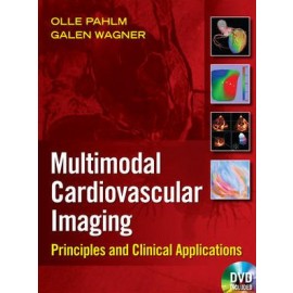 Cardiovascular Multimodal Image-Guided Diagnosis And Therapy