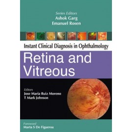 Instant Clinical Diagnosis in Ophthalmology: Retina and Vitreous