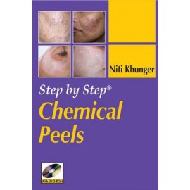 Step-by-Step Chemical Peels