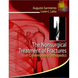 Nonsurgical Treatment of Fractures in Contemporary Orthopedics