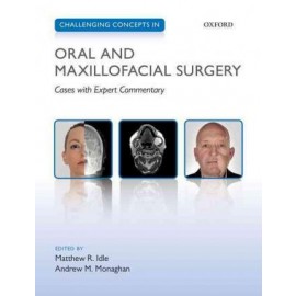 Challenging Concepts in Oral and Maxillofacial Surgery: Cases with Expert Commentary