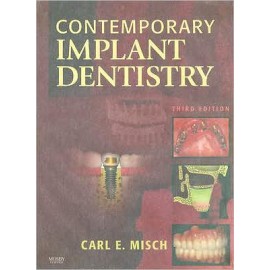 Contemporary Implant Dentistry, 3e