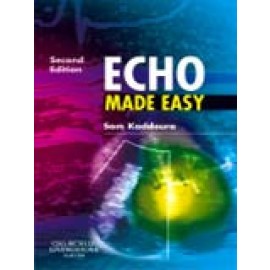 Echo Made Easy ,2e