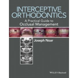 Interceptive Orthodontics: A Practical Guide to Occlusal Management