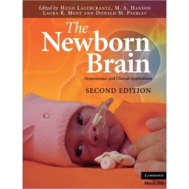 The Newborn Brain 2e