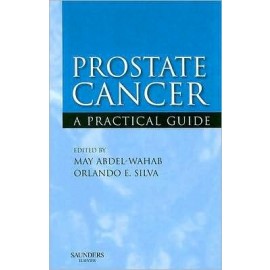 Prostate Cancer: A Practical Guide **