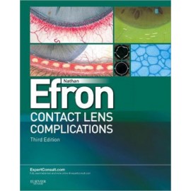Contact Lens Complications, 3e