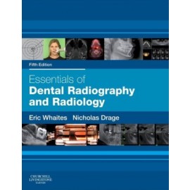 Essentials of Dental Radiography and Radiology, 5e