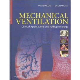 Mechanical Ventilation, Clinical Applications and Pathophysiology