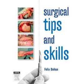 Surgical tips and skills