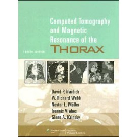 Computed Tomography and Magnetic Resonance of the Thorax, 4e