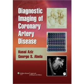 Diagnostic Imaging of Coronary Artery Disease **