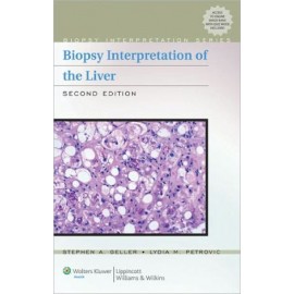 Biopsy Interpretation of the Liver, 2e