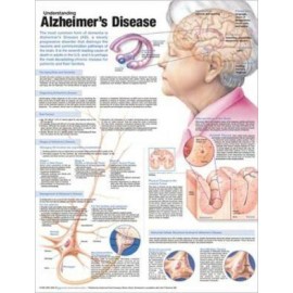 Understanding Alzheimer's Disease Chart 2E