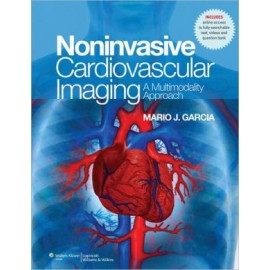 NonInvasive Cardiovascular Imaging: A Multimodality Approach **